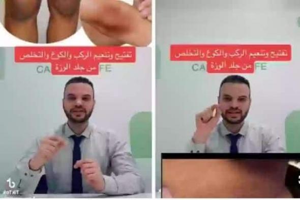 فيديو يكشف عن أفضل كريم في السعودية لتفتيح الأكواع والركب